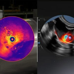 Ensaios de Termografia e Ultrassom